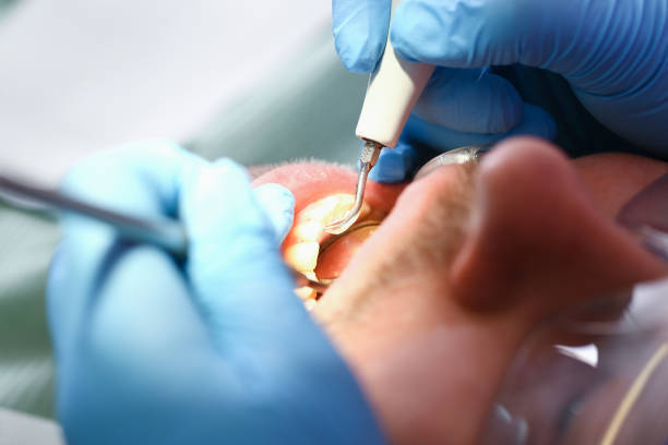 Best Emergency Tooth Extraction in Antioch, IL